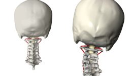 Stone Family Chiropractic Pamela Stone Kennesaw Marietta Chiropractor Vertebral Subluxation